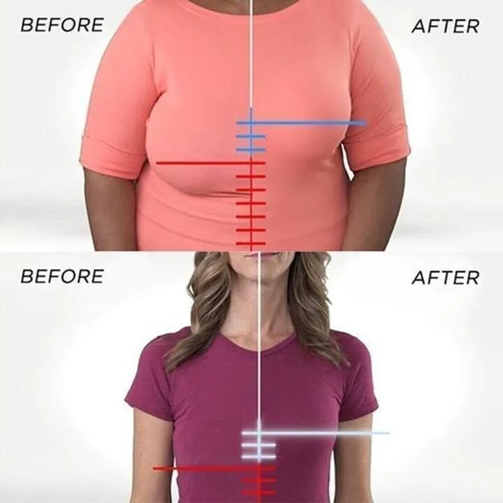 Lyro – SoftSupport Wire-Free Bra